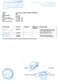 Купить анализ на ВИЧ, RW (сифилис) и гепатиты. Доступно в Москве.