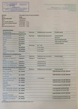 Купить общий анализ кала за 219 у.е. в Москве.